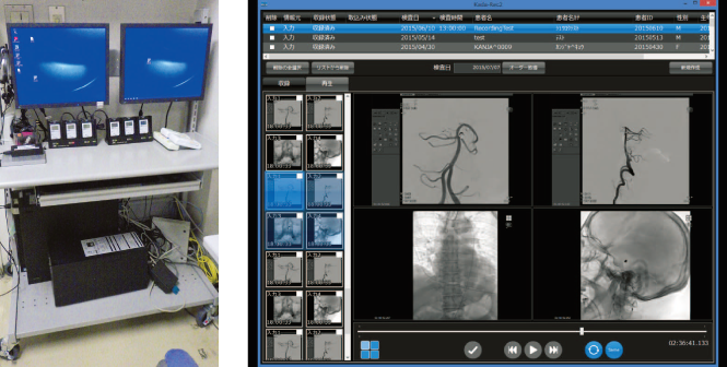 （左）図1 血管造影室に設置している「Kada-Rec2」（右）図2「Kada-Rec2」画面