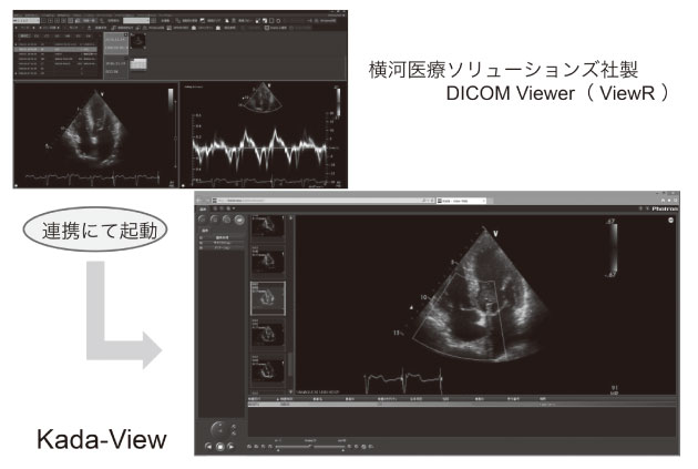 図２　ViewR から連携、電子カルテ端末から動画像が参照できる