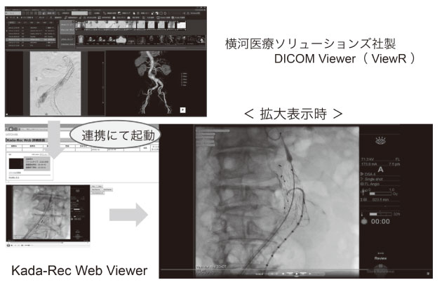 図３　ViewR から連携、電子カルテ端末から透視動画像が参照できる