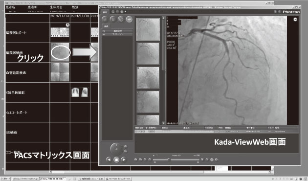 図2　PACS から展開するKada-View Web 画面